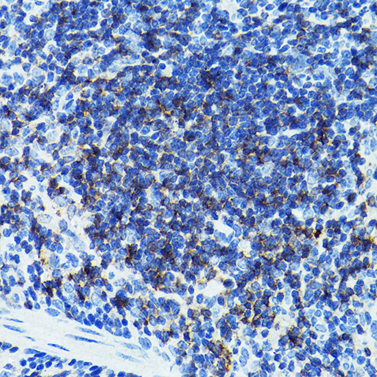 CD79b Antibody in Immunohistochemistry (Paraffin) (IHC (P))