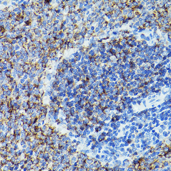 CD79b Antibody in Immunohistochemistry (Paraffin) (IHC (P))