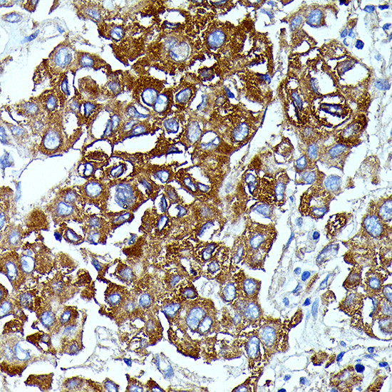 IL13RA2 Antibody in Immunohistochemistry (Paraffin) (IHC (P))