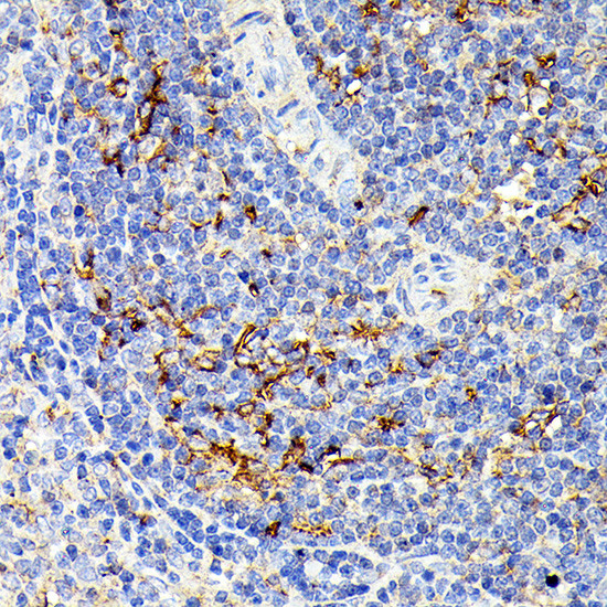 IL13RA2 Antibody in Immunohistochemistry (Paraffin) (IHC (P))