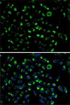 Adenylate Kinase 4 Antibody in Immunocytochemistry (ICC/IF)