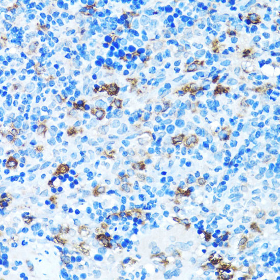 FGFR2 Antibody in Immunohistochemistry (Paraffin) (IHC (P))