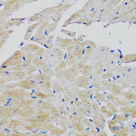 FGFR2 Antibody in Immunohistochemistry (Paraffin) (IHC (P))