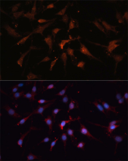 GSK3B Antibody in Immunocytochemistry (ICC/IF)