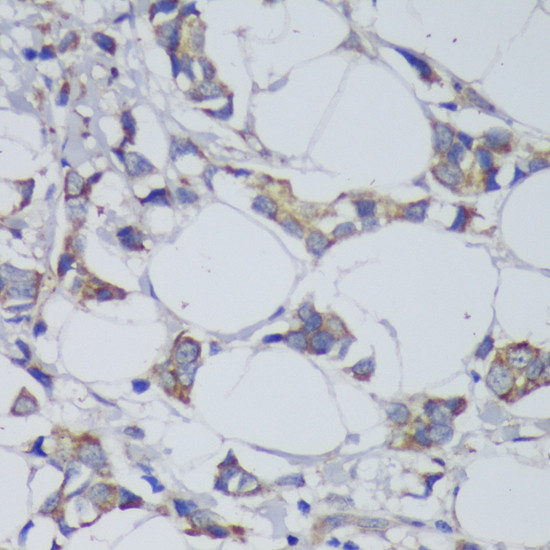 GSK3B Antibody in Immunohistochemistry (Paraffin) (IHC (P))