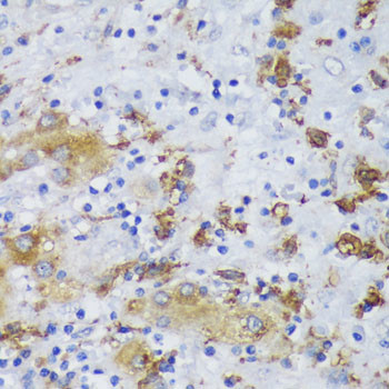 GSK3B Antibody in Immunohistochemistry (Paraffin) (IHC (P))