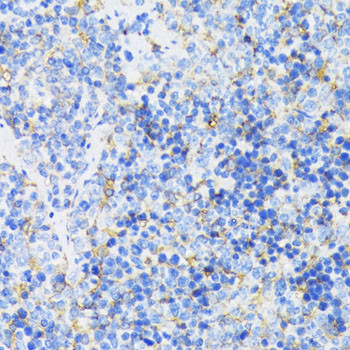 GSK3B Antibody in Immunohistochemistry (Paraffin) (IHC (P))