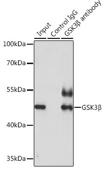 GSK3B Antibody in Immunoprecipitation (IP)