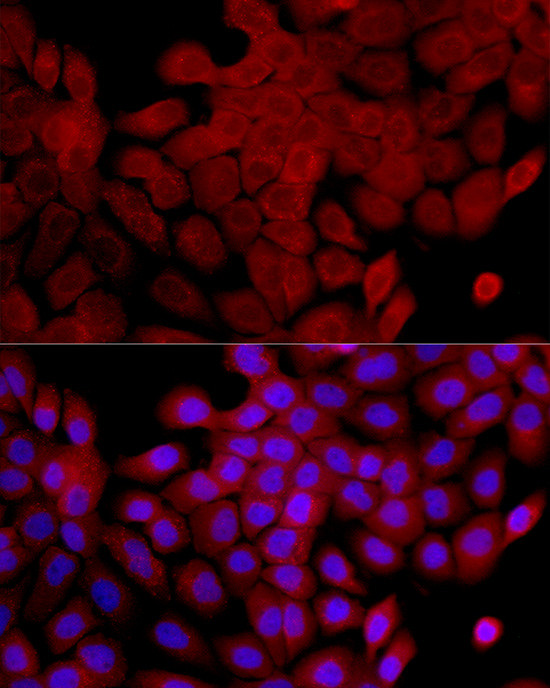 IL1RA Antibody in Immunocytochemistry (ICC/IF)