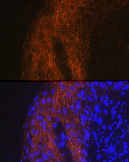 IL1RA Antibody in Immunohistochemistry (Paraffin) (IHC (P))