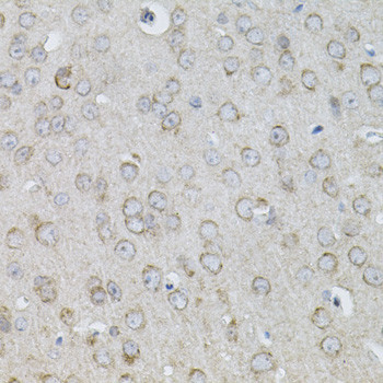 IL-13 Antibody in Immunohistochemistry (Paraffin) (IHC (P))