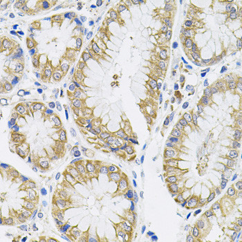 IL-13 Antibody in Immunohistochemistry (Paraffin) (IHC (P))