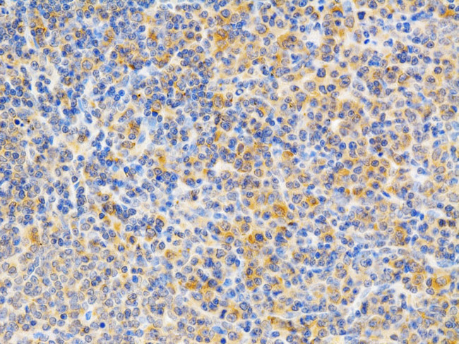 PKC epsilon Antibody in Immunohistochemistry (Paraffin) (IHC (P))