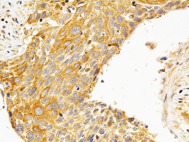 PKC epsilon Antibody in Immunohistochemistry (Paraffin) (IHC (P))