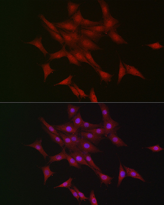 LKB1 Antibody in Immunocytochemistry (ICC/IF)