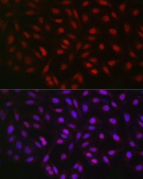 LKB1 Antibody in Immunocytochemistry (ICC/IF)