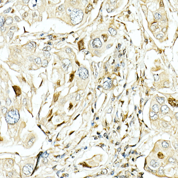 LKB1 Antibody in Immunohistochemistry (Paraffin) (IHC (P))