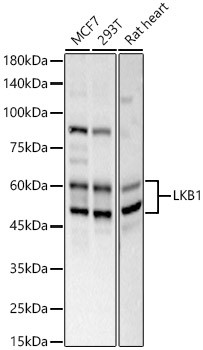 LKB1 Antibody in Western Blot (WB)