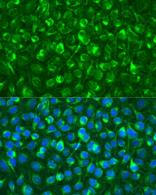 Syk Antibody in Immunocytochemistry (ICC/IF)