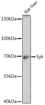 Syk Antibody in Western Blot (WB)