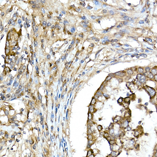 TNFAIP3 Antibody in Immunohistochemistry (Paraffin) (IHC (P))