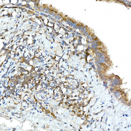 TNFAIP3 Antibody in Immunohistochemistry (Paraffin) (IHC (P))