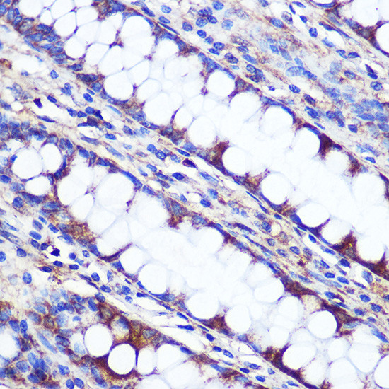 LETMD1 Antibody in Immunohistochemistry (Paraffin) (IHC (P))