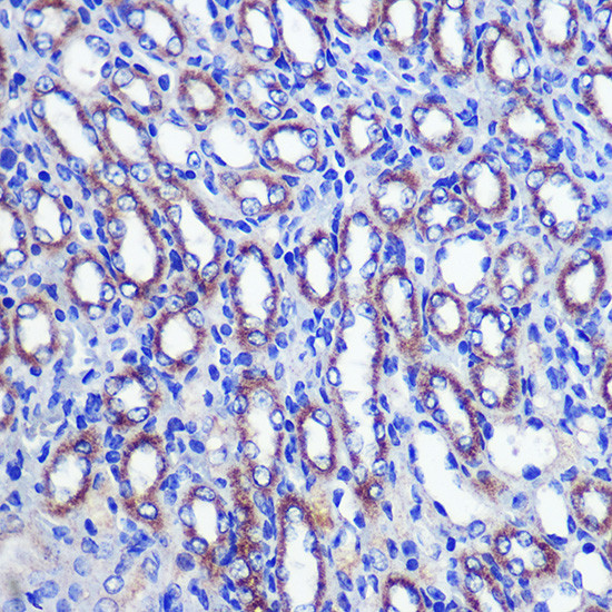 LETMD1 Antibody in Immunohistochemistry (Paraffin) (IHC (P))