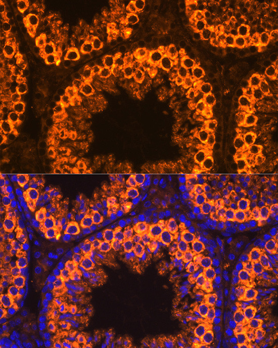 PIWIL1 Antibody in Immunocytochemistry (ICC/IF)