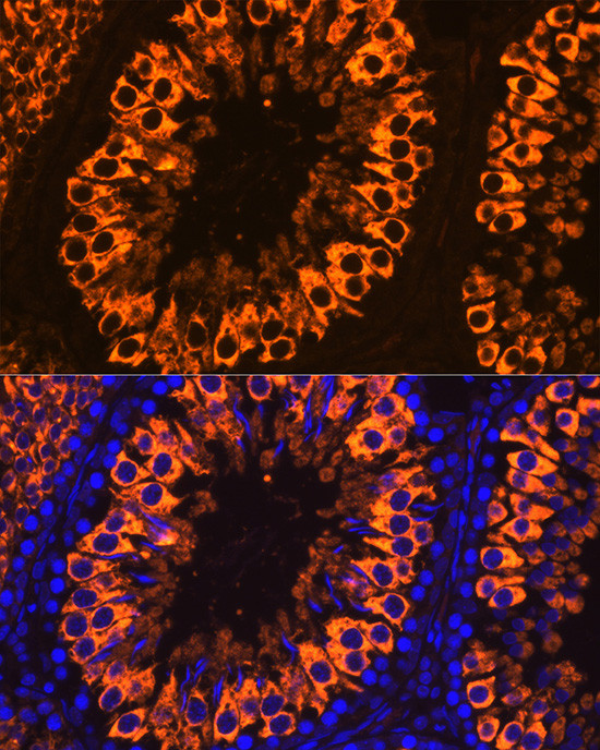 PIWIL1 Antibody in Immunocytochemistry (ICC/IF)