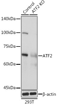 ATF Antibody in Western Blot (WB)