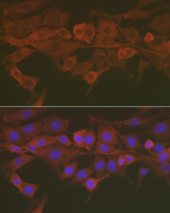 Caspase 3 Antibody in Immunocytochemistry (ICC/IF)