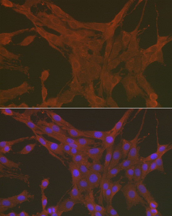 Caspase 3 Antibody in Immunocytochemistry (ICC/IF)