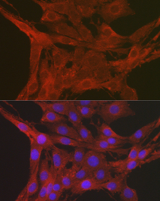 Caspase 3 Antibody in Immunocytochemistry (ICC/IF)