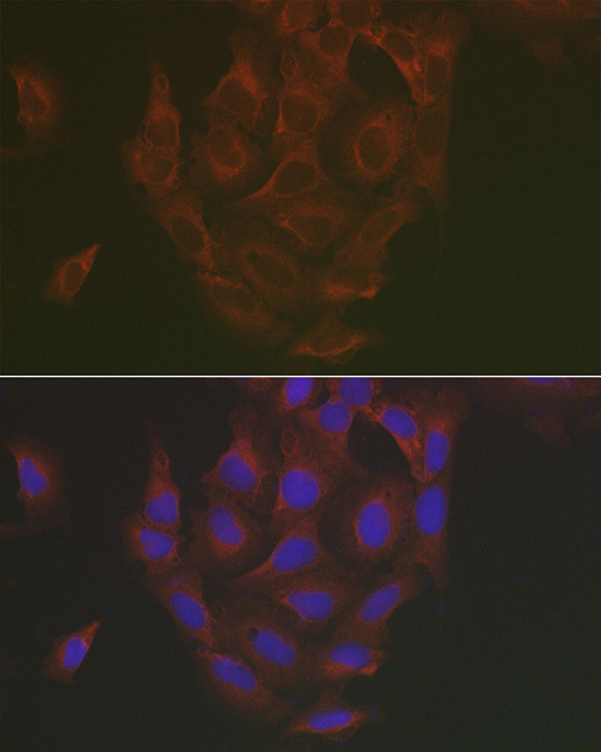 Caspase 3 Antibody in Immunocytochemistry (ICC/IF)