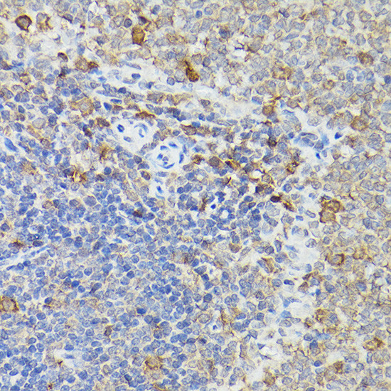 Caspase 3 Antibody in Immunohistochemistry (Paraffin) (IHC (P))