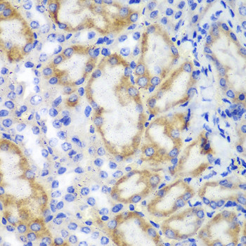 HCLS1 Antibody in Immunohistochemistry (Paraffin) (IHC (P))