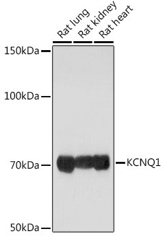 KCNQ1 Antibody in Western Blot (WB)