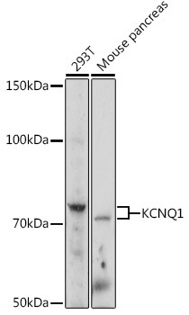 KCNQ1 Antibody in Western Blot (WB)