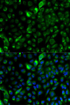 Cytokeratin 17 Antibody in Immunocytochemistry (ICC/IF)