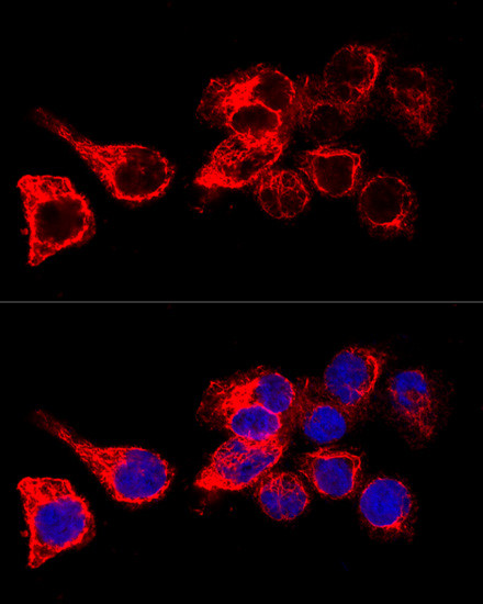 Cytokeratin 17 Antibody in Immunocytochemistry (ICC/IF)