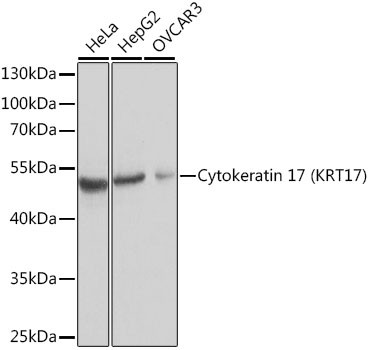 Cytokeratin 17 Antibody in Western Blot (WB)