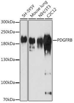 PDGFRB Antibody in Western Blot (WB)