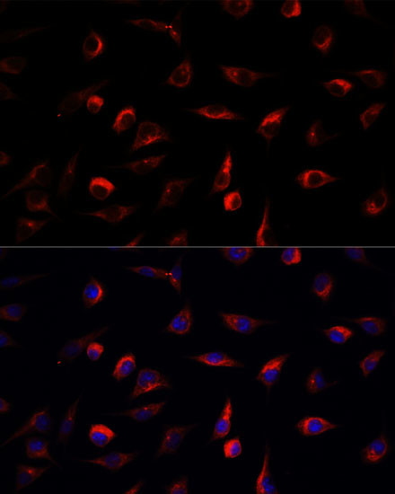 MEK7 Antibody in Immunocytochemistry (ICC/IF)