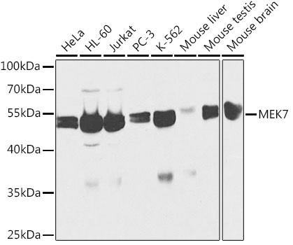 MEK7 Antibody in Western Blot (WB)