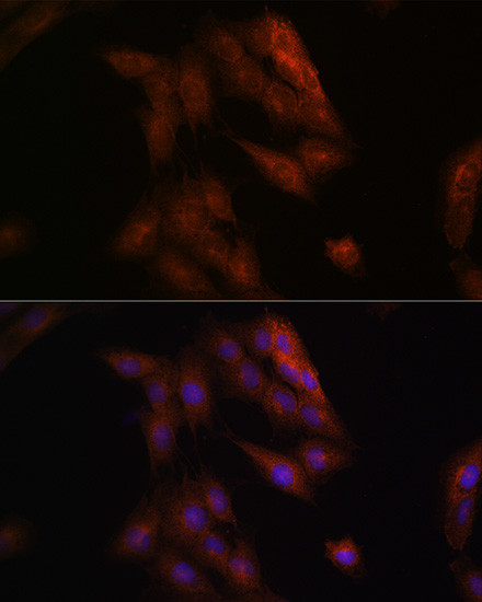 Presenilin 1 Antibody in Immunocytochemistry (ICC/IF)