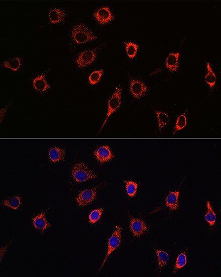 Presenilin 1 Antibody in Immunocytochemistry (ICC/IF)