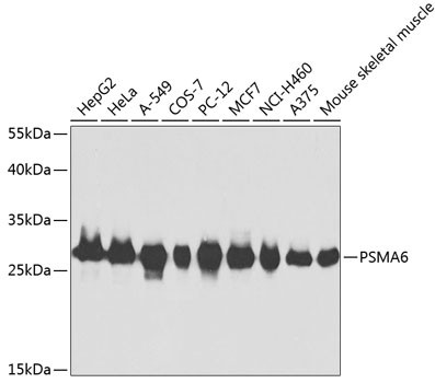 PSMA6 Antibody in Western Blot (WB)