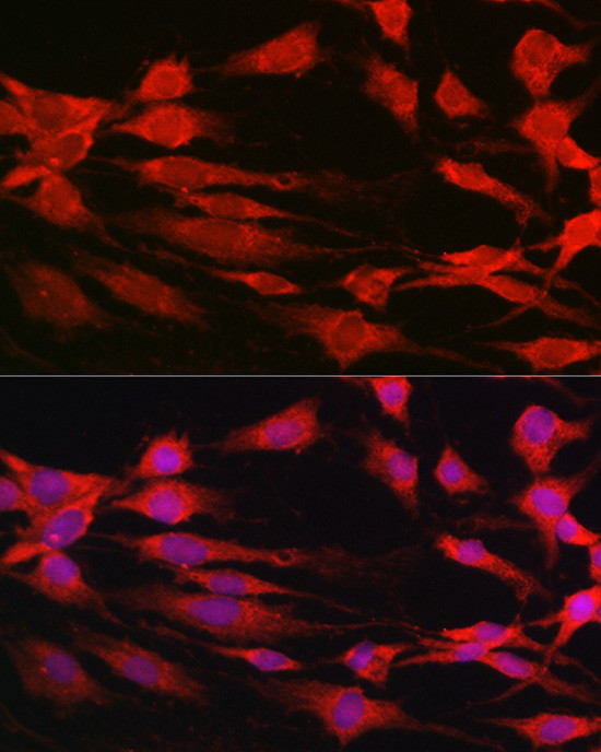 p70 S6 Kinase Antibody in Immunocytochemistry (ICC/IF)