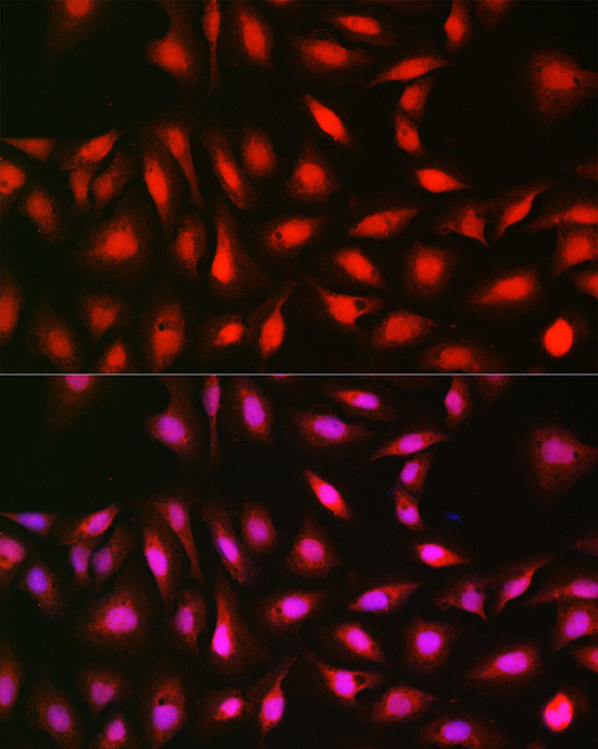 p70 S6 Kinase Antibody in Immunocytochemistry (ICC/IF)